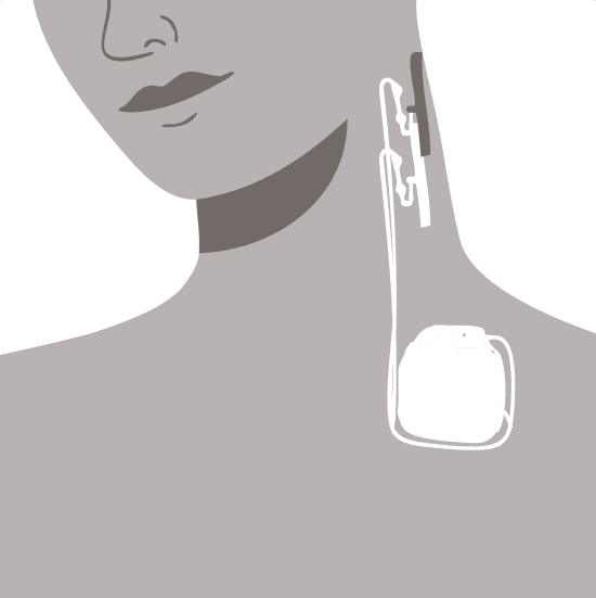 VNS-нейростимуляторы